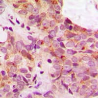 Polyclonal Rabbit anti-Human MAPT / Tau Antibody (C-Terminus, IHC, IF, WB)