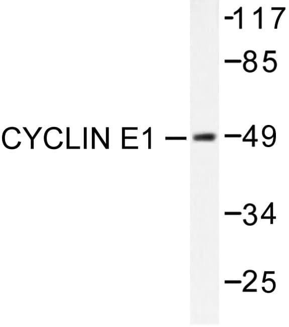 CCNE1 / Cyclin E1 Antibody (Leu389)