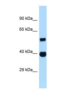 ASB4 Antibody (aa191-240)