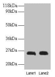PathPlus™ Placental Lactogen Antibody