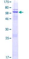Human DNAJC18 Protein (Recombinant GST)