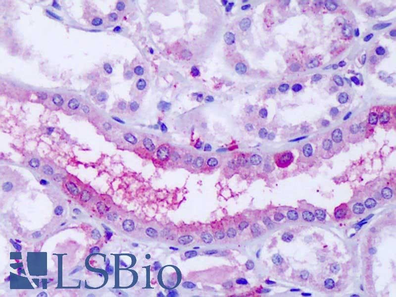 IHC-plus™ GPR80 / GPR99 / OXGR1 Antibody (Extracellular Domain)