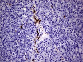 F13A1 / Factor XIIIa Antibody (clone OTI3F6)