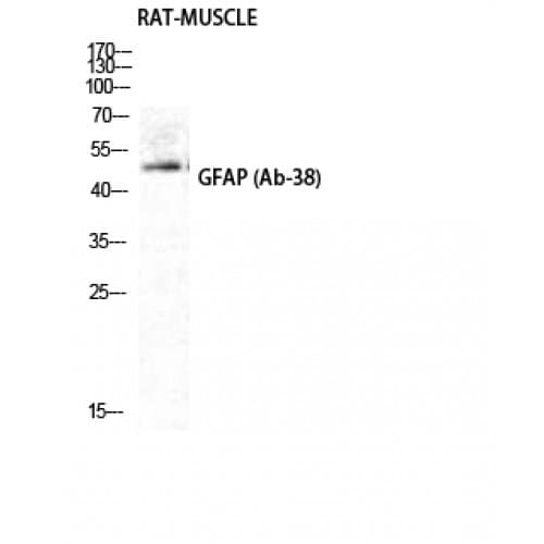 GFAP Antibody (30-110 aa)