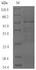 Burkholderia mallei Human guanine nucleotide exchange factor mRNA, complete cds. Protein (Recombinant 6His-SUMO, N-terminus)