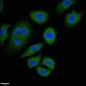 IHC-plus™ SUR2 / ABCC9 Antibody