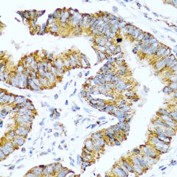 PathPlus™ GCG / Glucagon Antibody
