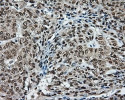 Monoclonal Mouse anti-Human TLDC1 / KIAA1609 Antibody (clone OTI5D9, IHC, IF, WB)