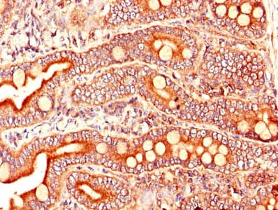 ARL6IP5 Antibody
