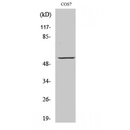 Polyclonal Rabbit anti-Human GPCR6 / GPR101 Antibody (430-510 aa, C-terminal, IF, WB)