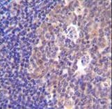PIK3R5 Antibody (aa763-792)