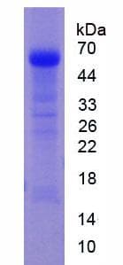 Human ACE / CD143 Protein (Recombinant His-GST)