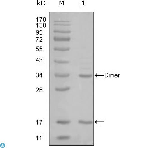 EP300 / p300 Antibody