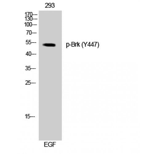 Polyclonal Rabbit anti-Human PTK6 / BRK Antibody (390-470 aa, IF, WB)