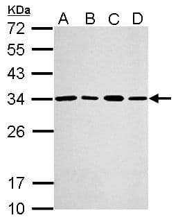 PSME3 Antibody (aa1-254)