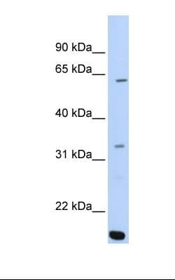 Polyclonal Rabbit anti-Human ARID5A Antibody (C-Terminus, IHC, WB)