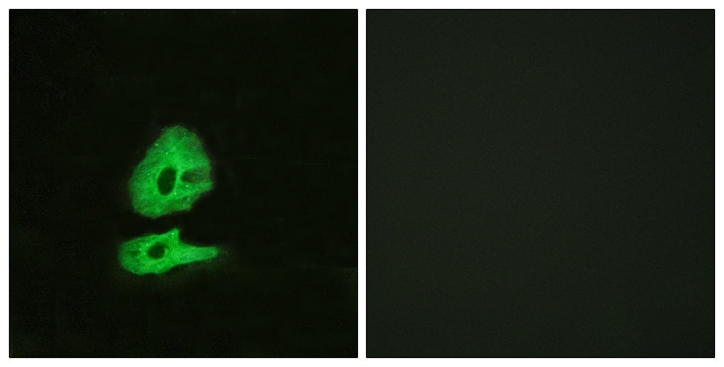GCGR / Glucagon Receptor Antibody