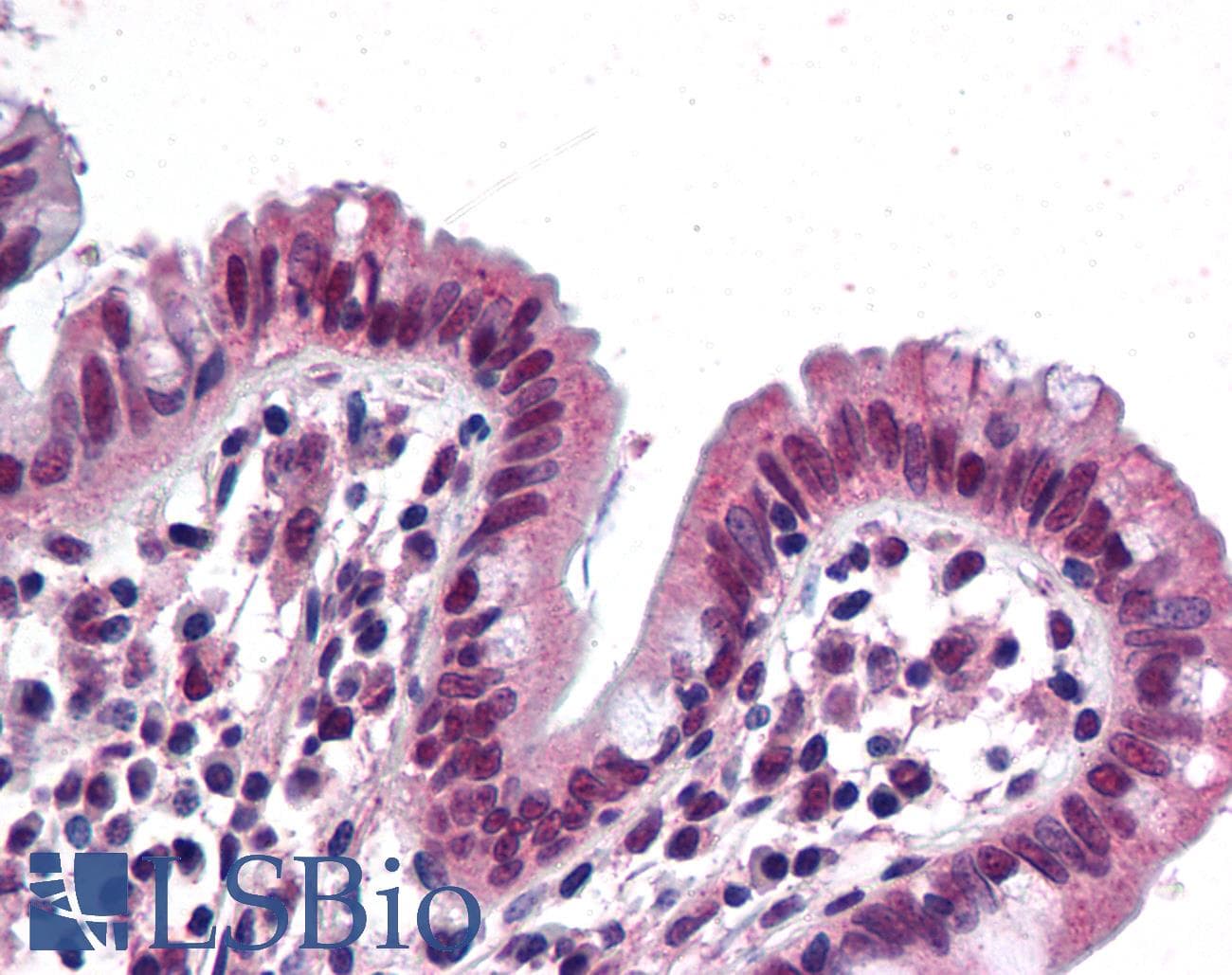 IHC-plus™ Monoclonal Mouse anti-Human SMARCB1 / INI1 Antibody (clone 3E10, IHC, WB)