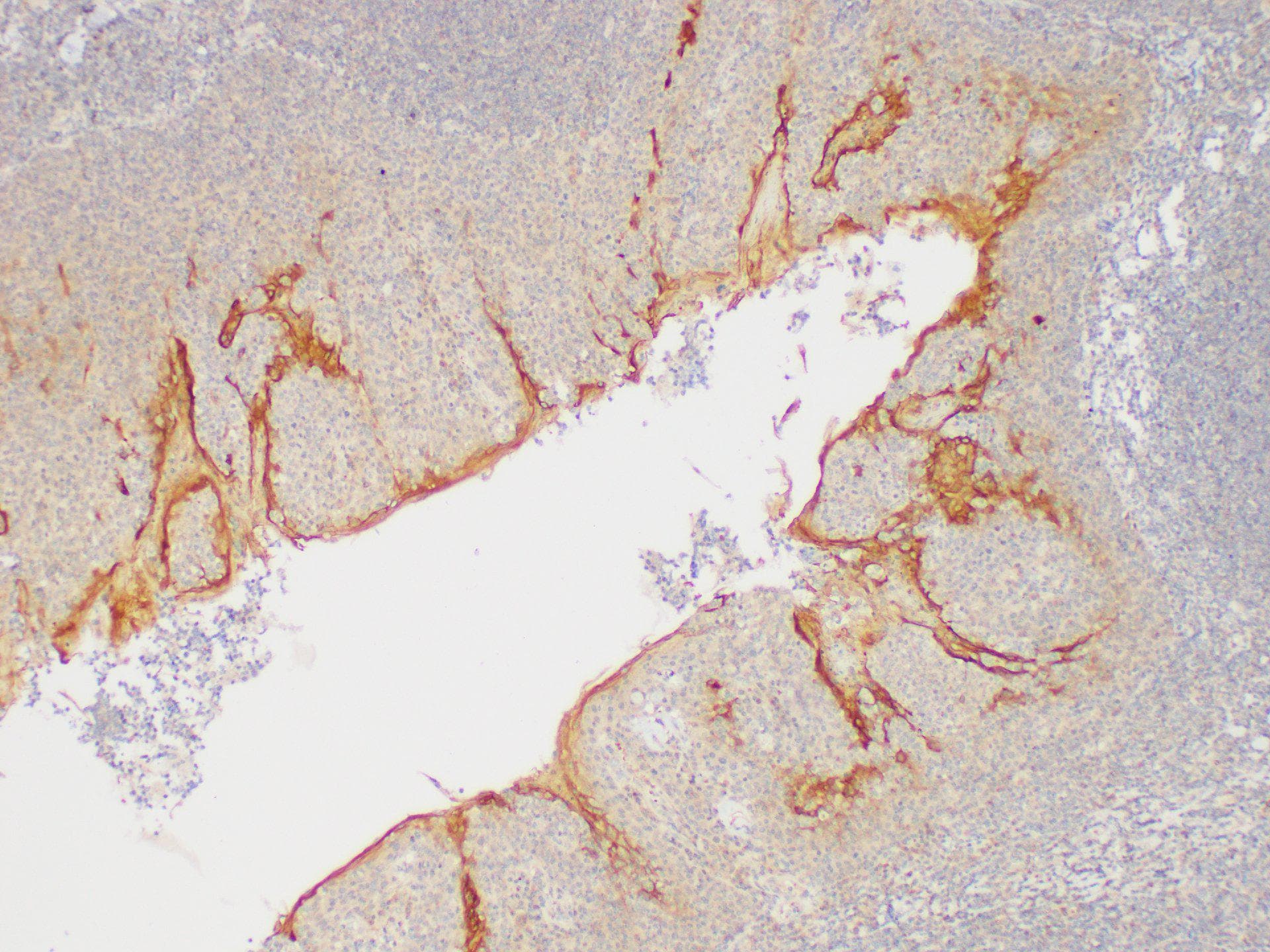 SERPINB2 / PAI-2 Antibody