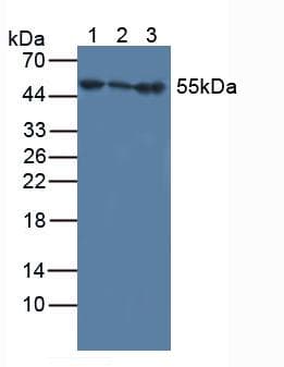 IFNAR1 / IFNAR Antibody (aa28-227, APC)