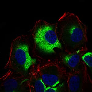 IHC-plus™ IL3RA / CD123 Antibody (aa200-305, clone 10B8E7)