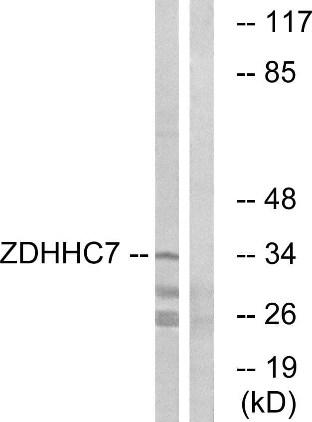 ZDHHC7 Antibody