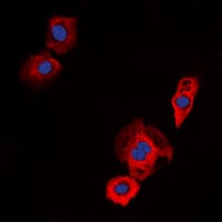 IHC-plus™ Polyclonal Rabbit anti-Human EGFR Antibody (C-Terminus, IHC, IF, WB)