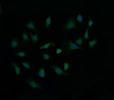 CTAG1B / NY-ESO-1 Antibody (clone OTI4C12)