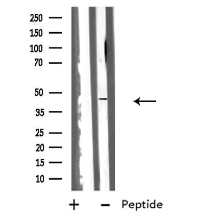 HSD17B2 Antibody