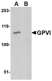 GP6 / GPVI Antibody