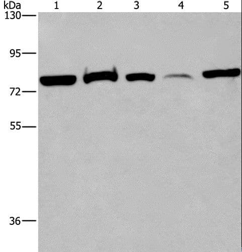 ACVR2 / ACVR2A Antibody