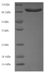 Human ACBD5 Protein (Recombinant 6His-SUMO, N-terminus)