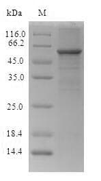 Laodelphax striatella CES1P1 / CES4 Protein (Recombinant 6His, C-terminus)