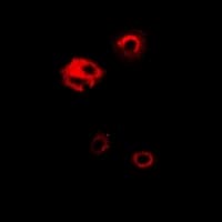 PGK1 / Phosphoglycerate Kinase Antibody