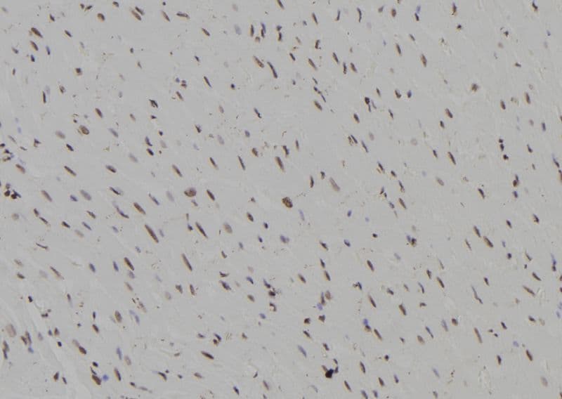 BCL11B Antibody