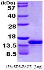 Human CCL4L1 Protein (Recombinant His)