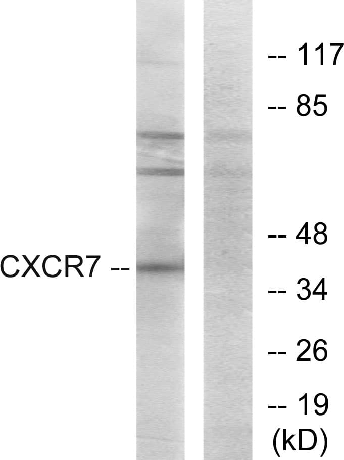 IHC-plus™ Polyclonal Rabbit anti-Human ACKR3 / CXCR7 Antibody (aa311-360, IHC, IF, WB)