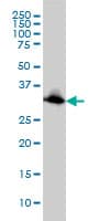 EMD / Emerin Antibody (clone 3B9)