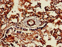 CAV2 / Caveolin 2 Antibody