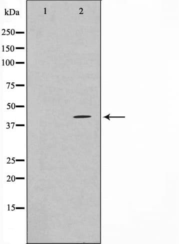 TBX10 Antibody