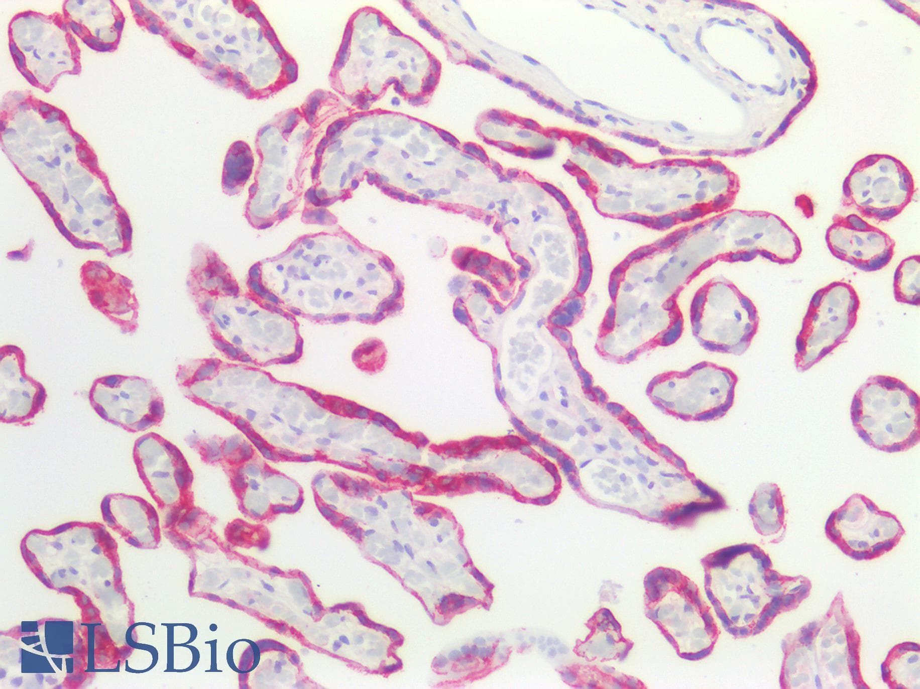 PathPlus™ Monoclonal Mouse anti-Human KRT7 / CK7 / Cytokeratin 7 Antibody (IHC, WB)