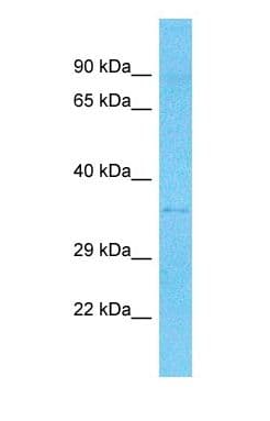 EPCAM Antibody (N-Terminus, HRP)