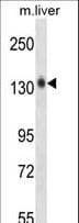 Polyclonal Rabbit anti-Mouse MST1R / RON Antibody (aa1013-1041, IHC, WB)