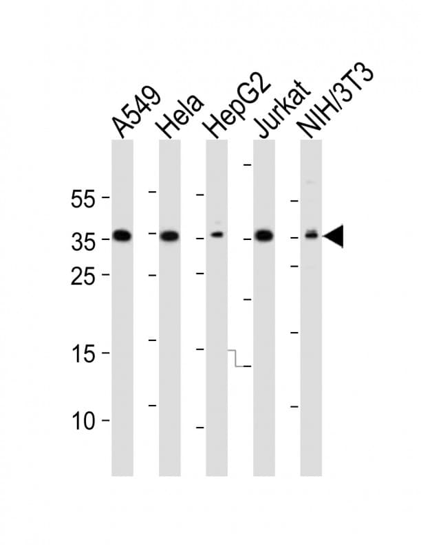 DKK1 Antibody