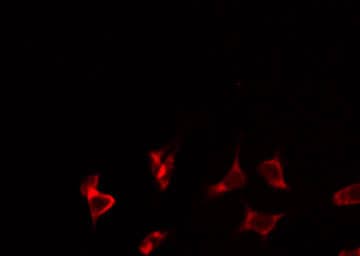TUSC2 / FUS1 Antibody