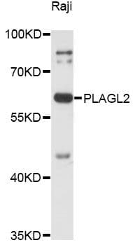 PLAGL2 Antibody