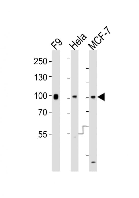 SUZ12 Antibody (aa496-530)