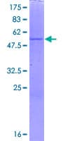 Human DHRS4 / PSCD Protein (Recombinant GST)