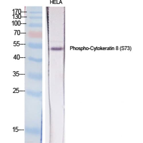KRT8 / CK8 / Cytokeratin 8 Antibody (10-90 aa)