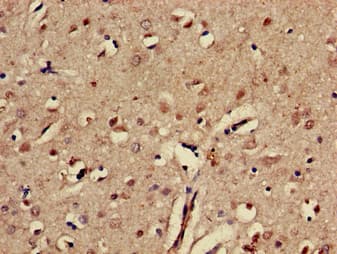 EPHA5 / EPH Receptor A5 Antibody